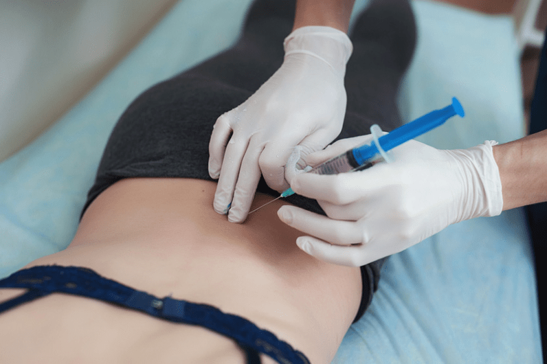 блокада при лумбална остеохондроза